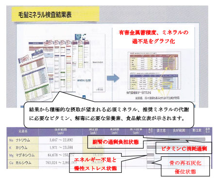 予防医研FOMAN｜毛髪ミネラル検査による正確性の高い分析